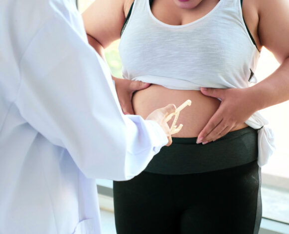 otyłością otyłością