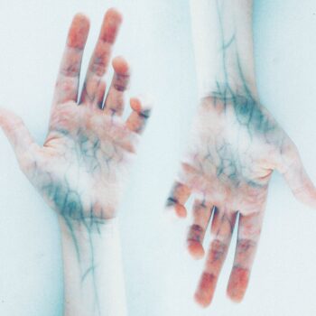 pexels-elīna-arāja-3462741 Witamina K – witamina k2 oraz k2 mk7 co to jest?